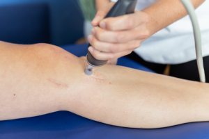 LymphaTouch - managementul cicatricilor